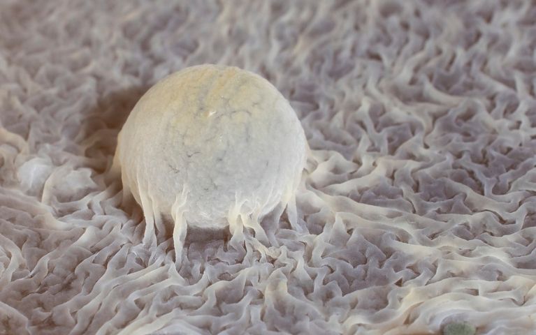 Lievito di kahm al microscopio